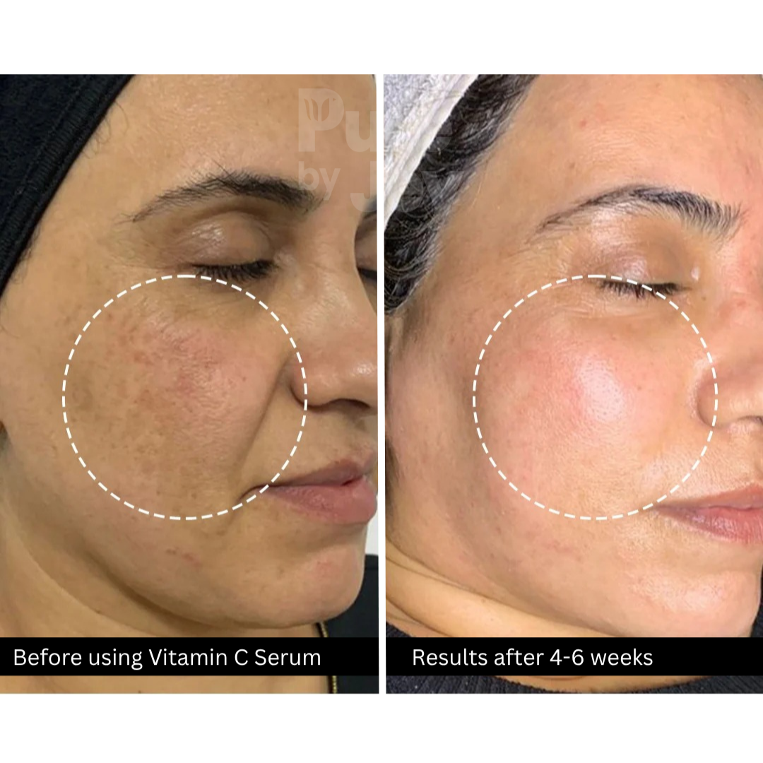 Vitamin C Serum - 10% Vit C + 2% Ferulic Acid