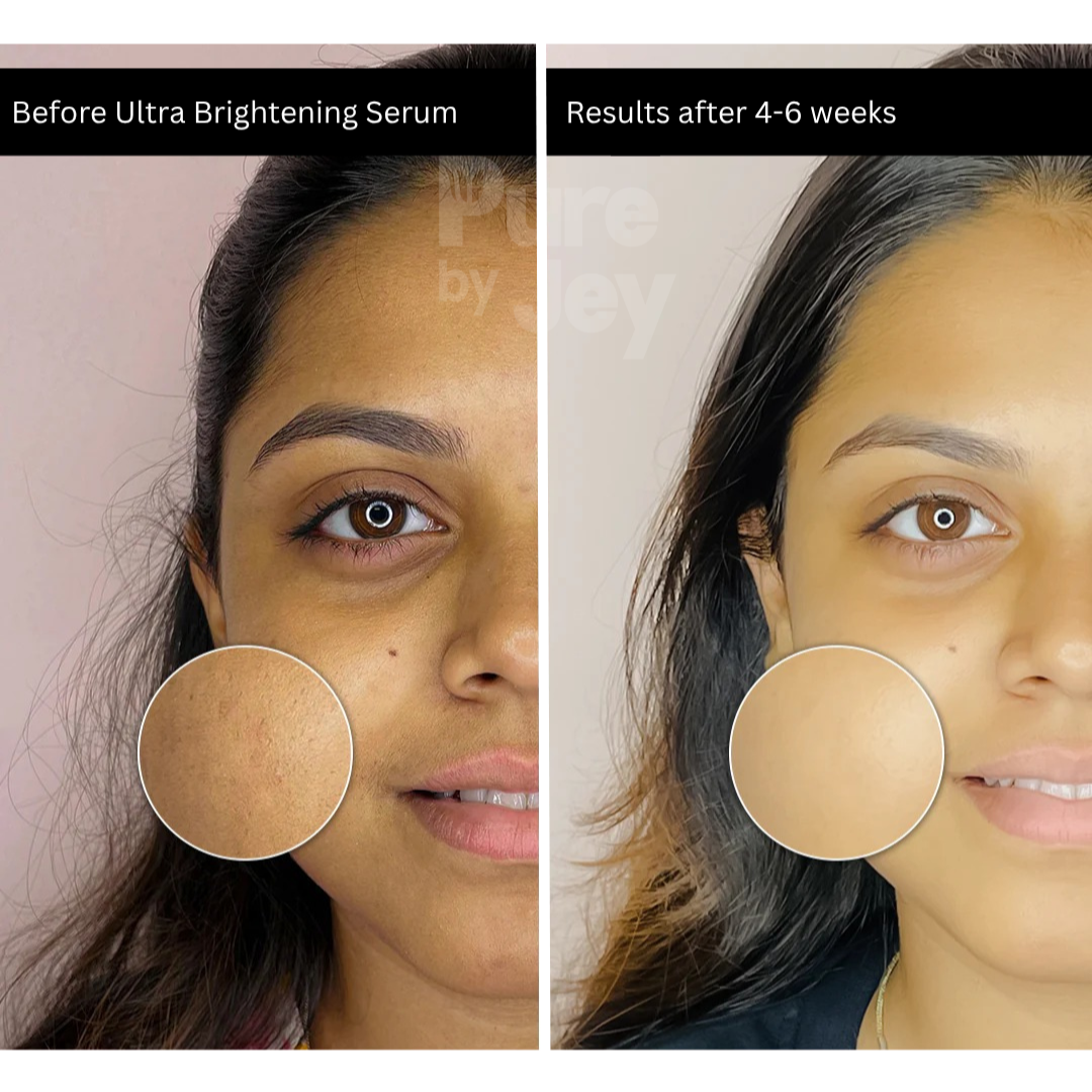 Ultra Brightening Serum - 1% Glutathione + 2% Vit C + 1% Alpha Arbutin