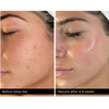 Glow Gel