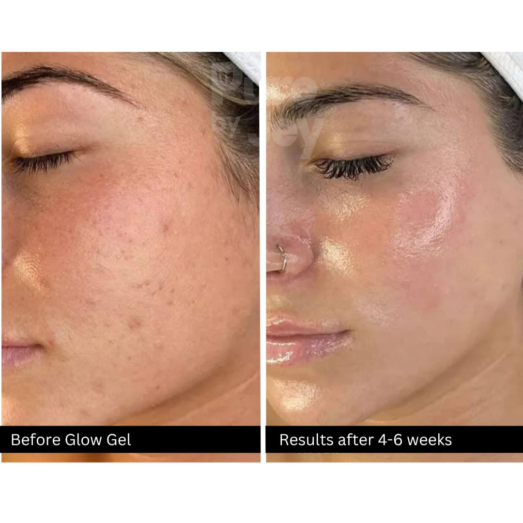 Glow Gel