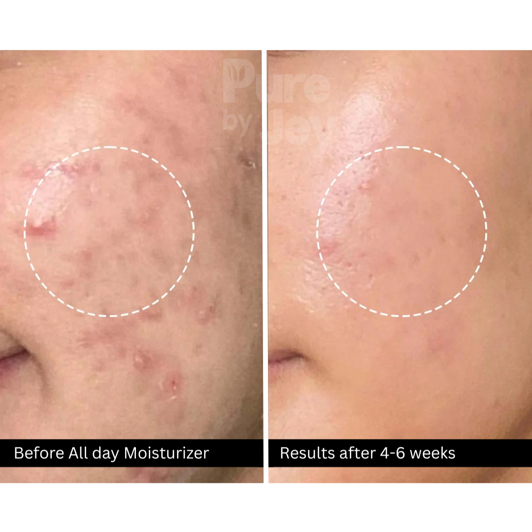 All-Day Moisturizer with SPF 15