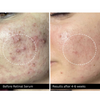 Retinal Serum - 0.5% Retinoyl Pal + 0.05% Retinal